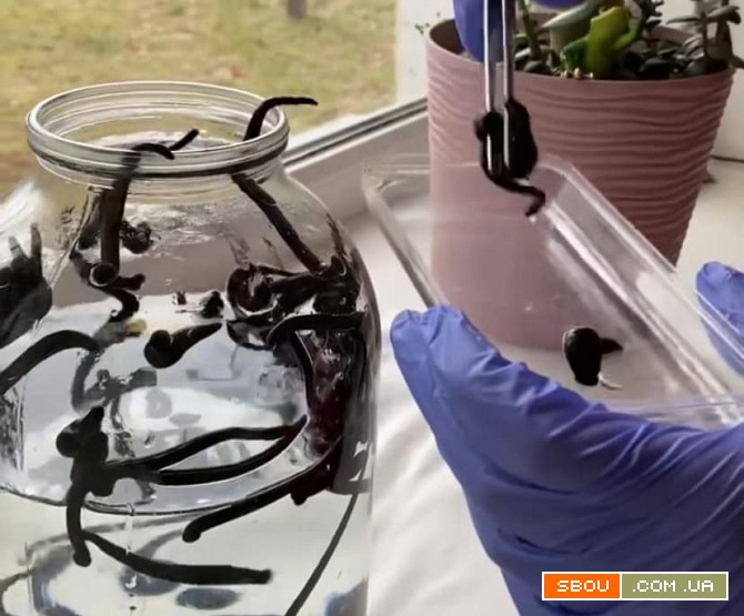 Гірудотерапія - лікування у санаторії "Хмільник" Хмельник - изображение 1